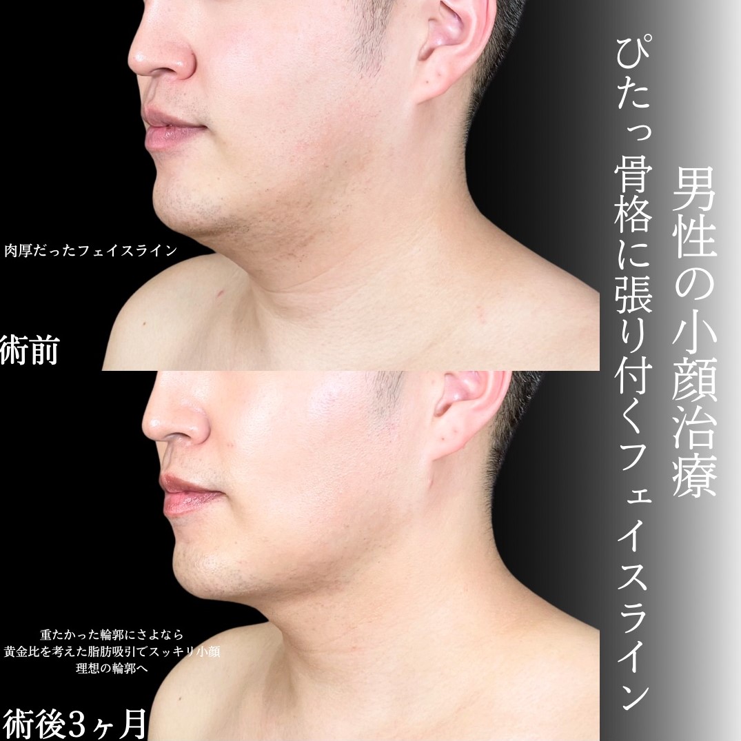 No.16546の症例写真1